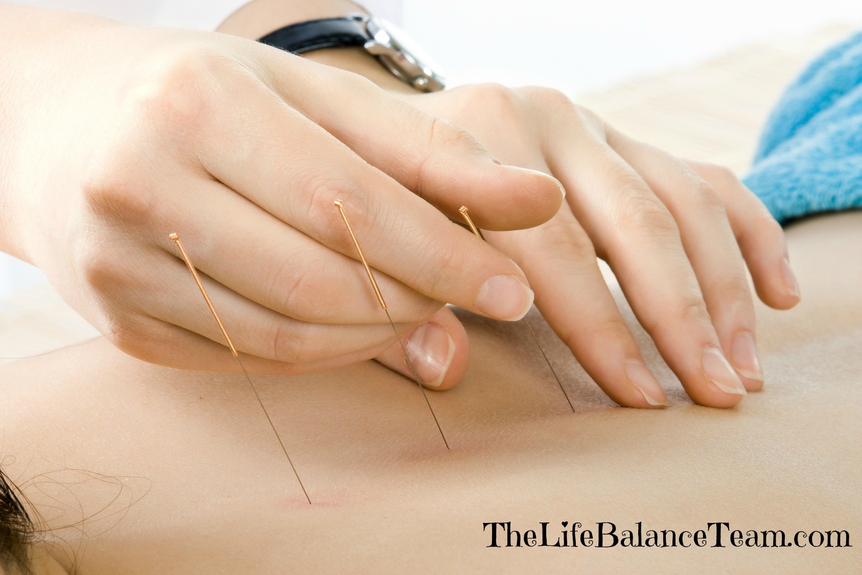 Acupuncture – What is it and how does it work?